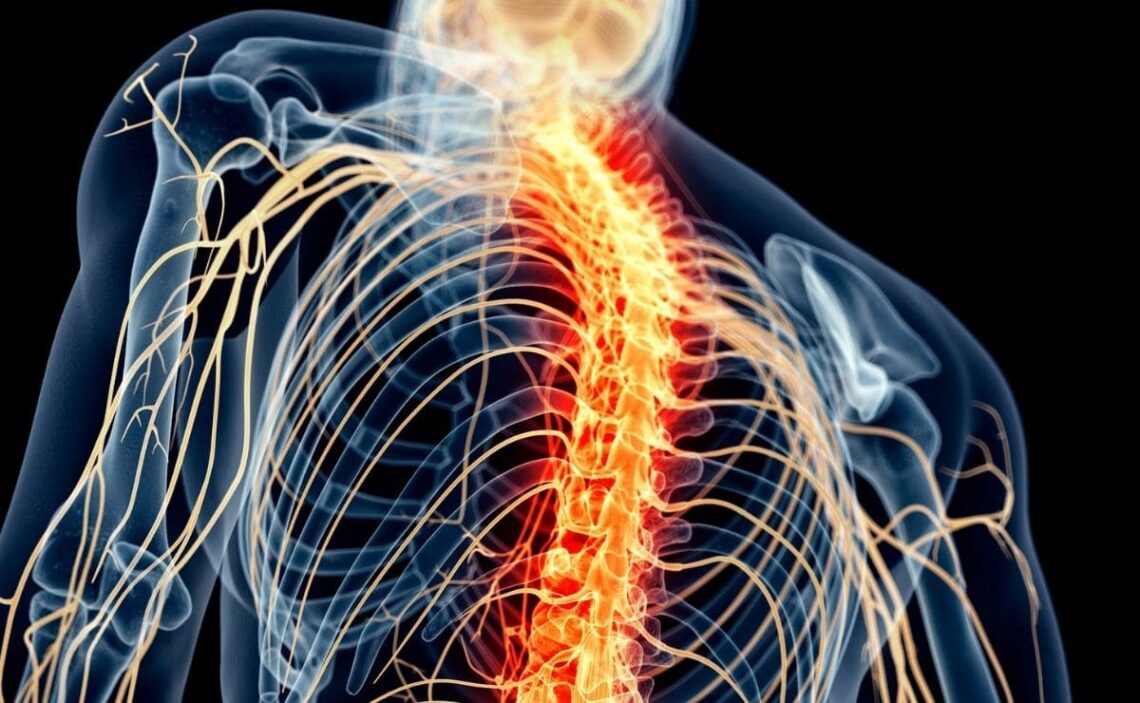 Un implante electrónico logra reactivar los nervios de la médula espinal y permite volver andar a una mujer con discapacidad