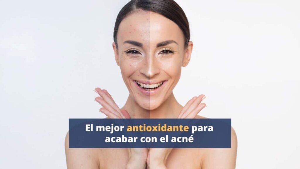 El mejor antioxidante para acabar con el acné