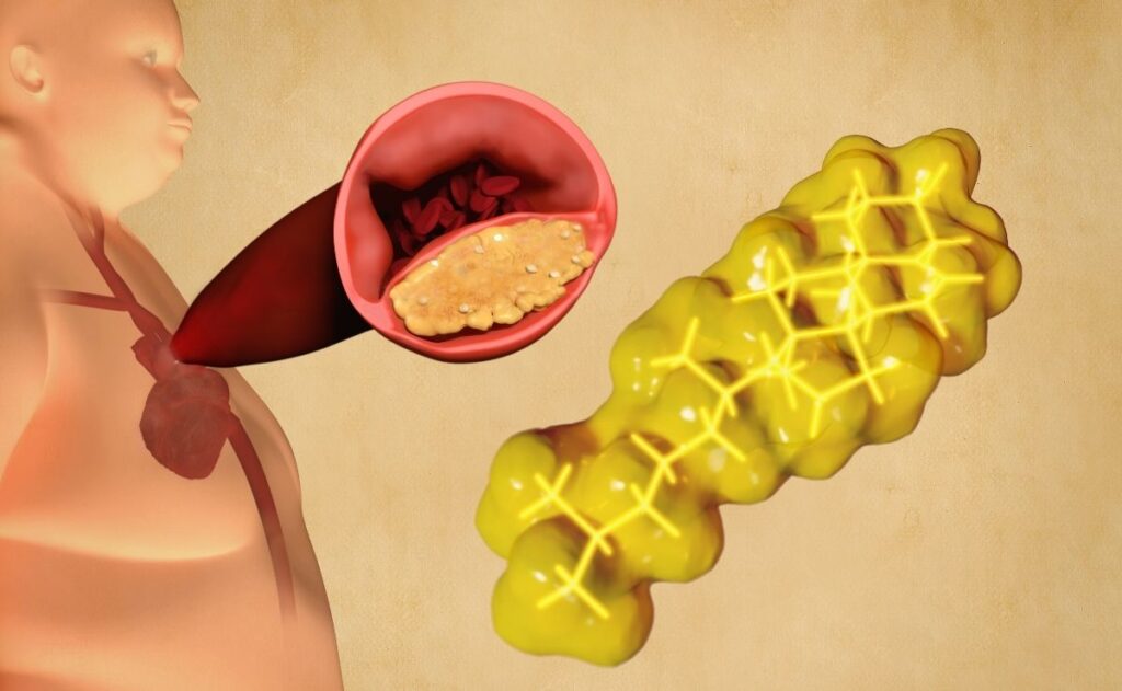 medicamento colesterol salud sangre sanguíneo tensión arterial médico circulación