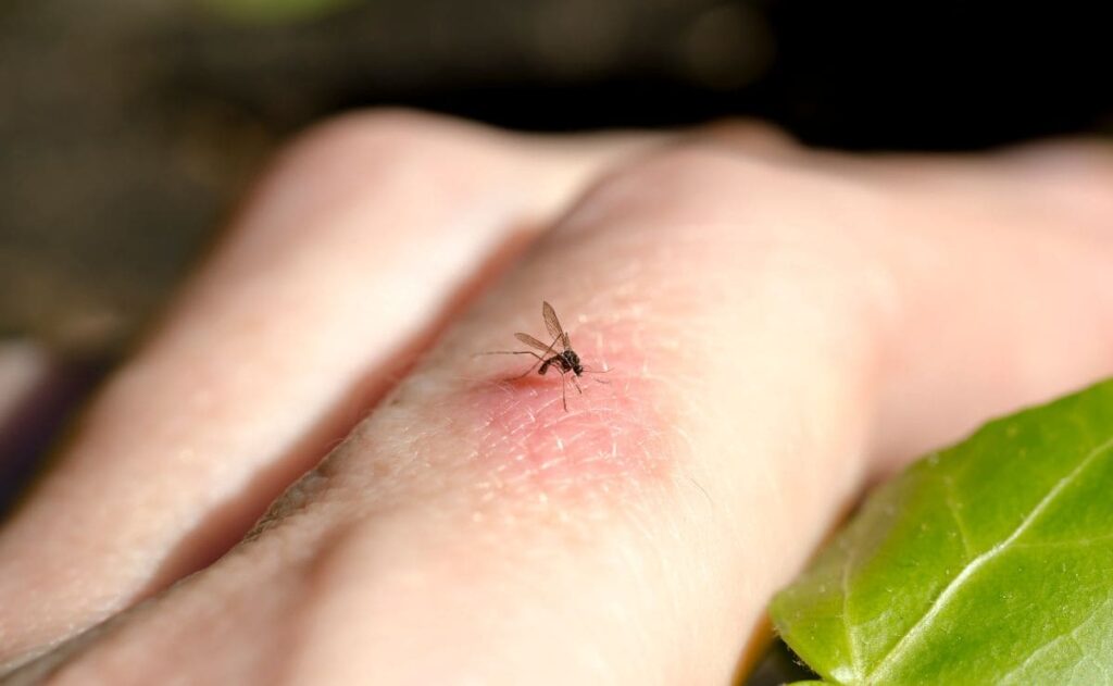 Así puedes usar el bicarbonato para aliviar las picaduras de mosquito