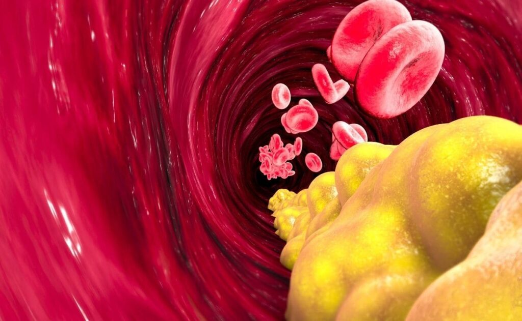 triglicéridos colesterol sangre alimento circulación tensión arterial salud